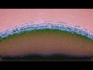 party python emotional squeeze