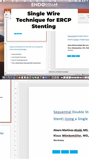 EndoCollab | GI Endoscopy Community on Instagram: "Stent pushing technique for double-balloon ERCP explained. Patient case: jaundice & liver issues post-transplant. An effective technique. #gastroenterology #gastroenterologia #endoscopy #endoscopia"