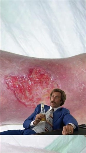 Wound Care Tips That Actually Work #shorts #nursing #woundhealing