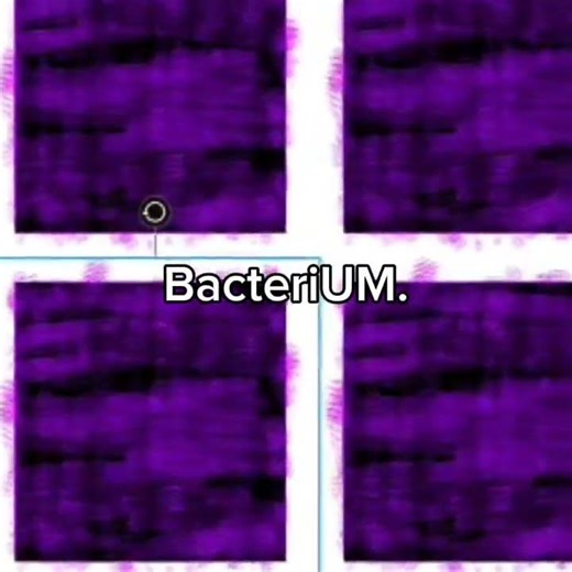 Make sure to get all BacteriUMs parts guys 🥹 #error_code #art #bacteriumerror_code #errorcoderoblox