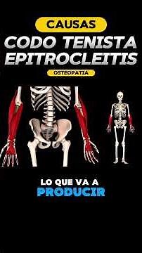 Causas EPITROCLEITIS o codo de golfista