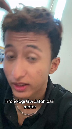 Kronologi Jatuh dari Motor dan Luka yang Dialami