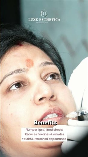 Face Fillers Guide 🔥 Benefits, Treatment Areas & Results