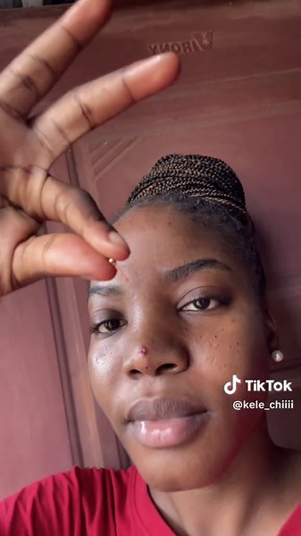 Infected Nose Piercing: Special Effects Makeup Tutorial