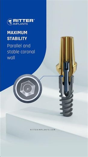 Ritter Implants - HEX Connection