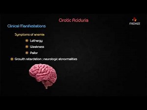 Orotic aciduria - Usmle biochemistry case based discussion