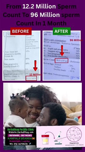 Understanding Low Sperm Count and Fertility Issues