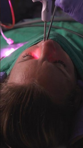 What happens during a balloon sinuplasty? #balloonsinuplasty #nasalcongestion #entcare