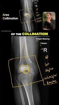 KNEE X-Ray Critique (Case 2, Part 2)