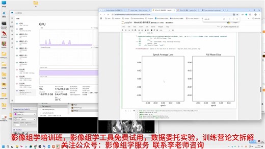 结直肠癌T分期自动化分割的深度学习方案