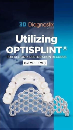Precision starts with the right records.Get a first look at the full OPTISPLINT® ‪@digitalarches‬
