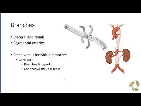 Thoracoabdominal Aneurysm Repair