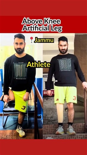 Above Knee Artificial Leg #abovekneeprosthetic #prostheticlimb #artificialleg #artificiallimb #short