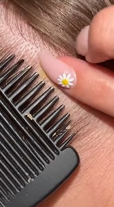 15K views · 35 reactions | Relaxing scalp dandruff on head removal (9) | Showerer | Facebook