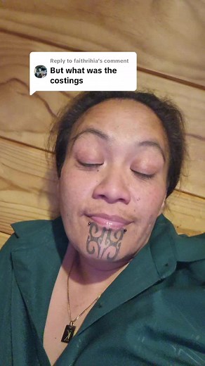 Affordable Denture Costings for a Pain-free Smile