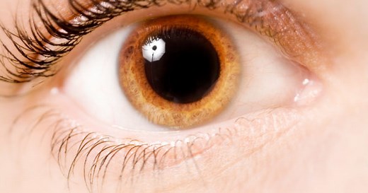 Intraoperative Miosis in Cataract Surgery