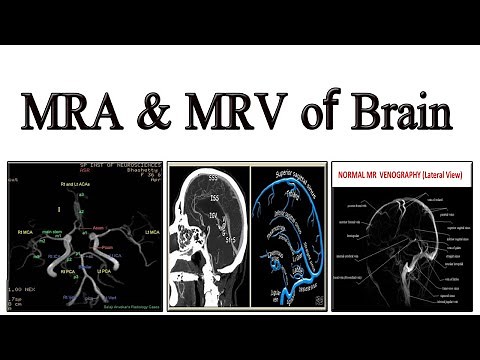 MRA & MRV of Brain
