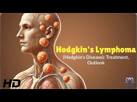 Hodgkin's Lymphoma: Everything You Need to Know in Under 10 Minutes!