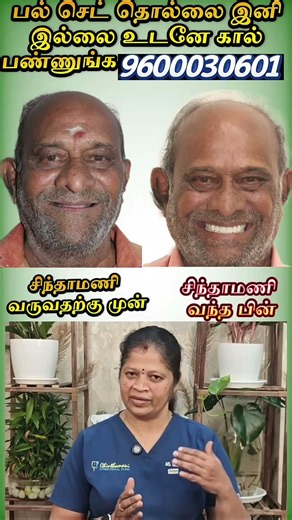 பல் செட் தொல்லை இனி இல்லை! 9600030601