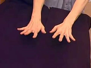 Cerebellar intention tremor