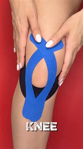 1.4M views · 5.9K reactions |  Support your knee with every step: learn how to apply kinesiology tape to stabilize the patella and move with confidence. 例 #Kinesiotape #StrongKnees #FunctionalTaping | Kinetape Academy | Facebook