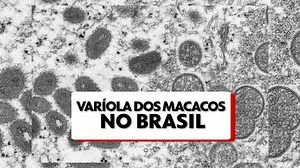 Varíola dos macacos: o que você precisa saber