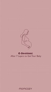 1.5K views · 30 reactions | What happened when giving birth to a baby through a C-section? You worked hard! To all cesarean #moms.❤️❤️ | Momcozy | Facebook