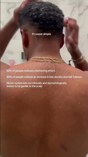 😳 Hair Thinning? 30 Days with Nioxin Hair Growth System Results