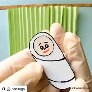 Cesarean Section #CS | General Nursing Students