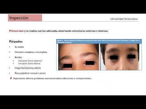 Valoración del Ojo 👁️ | Exploración Física por Regiones Anatómicas