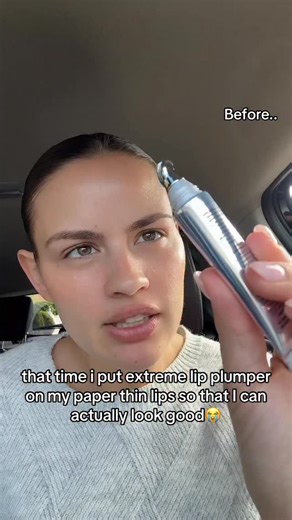 Get Bigger Lips Within 5 Mins ⏰🎀 | i’m really not gatekeeping this anymore i use this when i want my lips to look freshly done without doing the most warm tingle instant... | Instagram