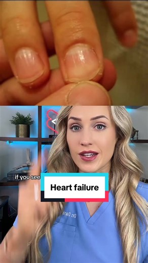 Did you know about this? #cardiachealth #hearthealth #medical #safety | heart