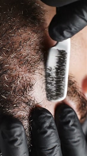 PART_18 | The First Micro Pop 🤏✨소리필수!! #skincare #shorts