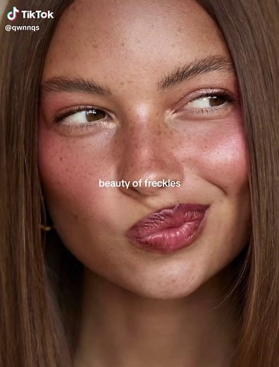 The Beauty of Freckles: Embracing Imperfections