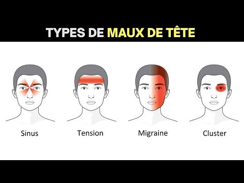 Différents types de maux de tête | Signe, symptômes et traitements