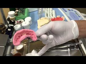 Temporary teeth made (7/13) Immediately cured resin is applied to the impression surface and pres...