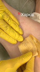 Perfect Armpit Waxing #waxingtiktok #asmr #waxing #hardwax #reelsfypシ #reels2023 #reelsvideo #reelsfb #reelsviral #HairWaxing #face #waxing #brazilianwax #reelschallenge #reelsfb #usa #unitedstates #acne #removals | IniyaShow2