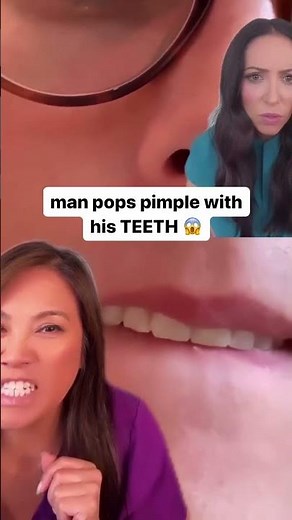 popping pimples with your teeth? #shorts