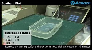 1K views · 84 reactions | C'est quoi la technique de Southern Blot...