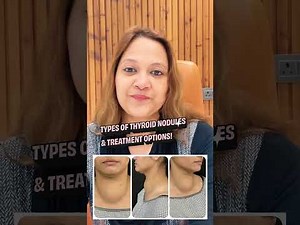 🌟 Understanding Thyroid Nodules & Treatment Options 🩺 | #ThyroidNoduleAblation