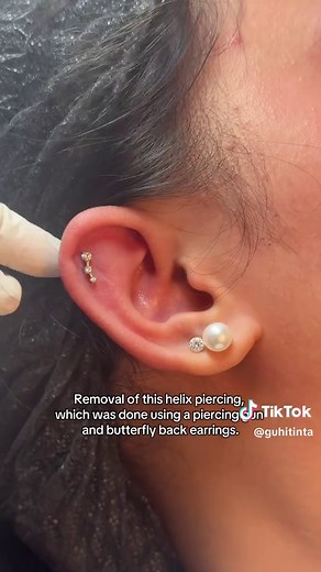 Helix Piercing Removal Guide with Piercing Gun