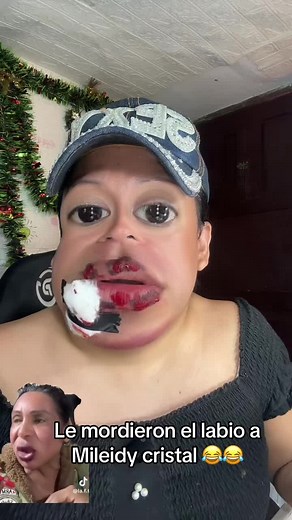Le mordieron a Mileidy cristal 😂#chikotina #mileidycristal