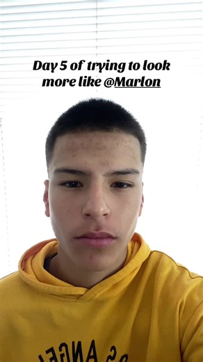 Day 5 of Buzzcut Journey Inspired by Marlon