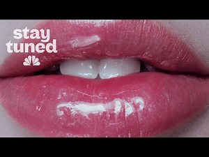 Why plastic surgery patients are getting younger | #FillerNation