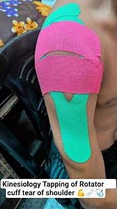 kinesiology Tapping of Rotator cuff tear of shoulder 💪#kinesiologytape #physiotherapy#shorts#tapping