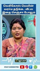 வெரிகோஸ் வெயின் வராம தடுக்க வீட்ல இதை செஞ்சா போதும்.. - Dr.Kavitha #Doctoroncall #Puthuyugamtv