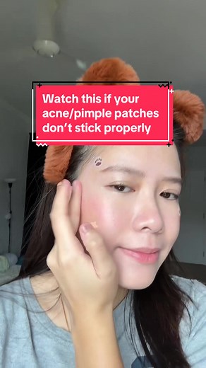 How to Keep Your Acne/Pimple Patches On All Day | Expert Tips