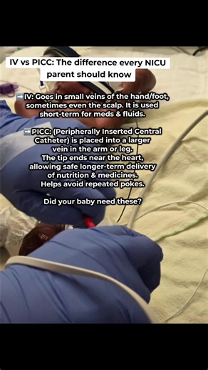 NICU babies’ veins are so tiny that IVs don’t last long. That’s why many need PICC lines. They are safer for longer-term nutrition & medicines, and fewer pokes. 💉 ✨ Did your baby need one of these? #NICU #NICUmom #NICUbaby #Preemiebaby #NICUawareness