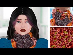 NEW ASMR ANIMATION AND NECK TREATMENT ‪@restasmr1‬