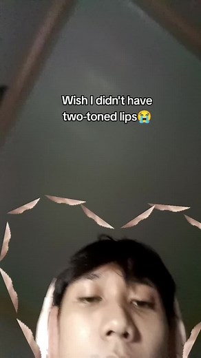 Dealing with Two-Toned Lips Insecurities: Tips and Tricks